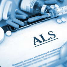 Mozek pacienta s ALS nakonec není schopen ovládat většinu svalů a pacient zůstává paralyzován při zachování psychických a mentálních schopností