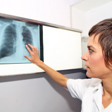 Test se provádí z krve a je možné jej podstoupit u lékařů nejrůznějších specializací, například u pneumologa, praktika či alergologa