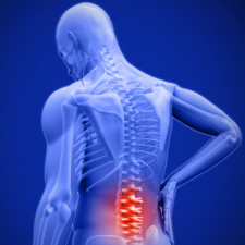 Bolesti zad patří mezi nejrozšířenější civilizační choroby