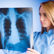 Kouření prokazatelně může za větší riziko vzniku rakoviny plic, toto tedy můžeme rozhodně ovlivnit