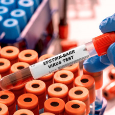 Virus Epsteina–Barrové (lidský herpesvirus 4 nebo EB virus), je virus z čeledi herpes virů