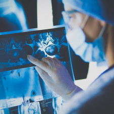 Strava působící preventivně proti rakovině obsahuje hlavně vysoké množství vlákniny